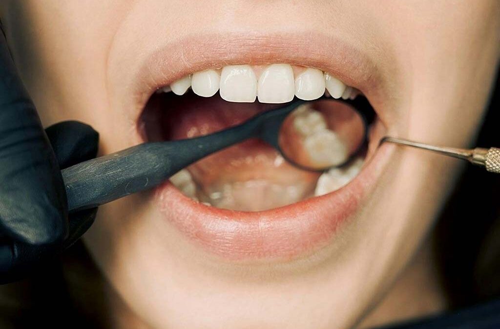 L&rsquo;Autonomie des hygiénistes dentaires au Québec : Ce que vous devez savoir